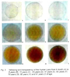 Figure 25 shows the effect aging has on the human eye. As we grow older, the lens becomes discolored (darkens), thus reducing visibility.