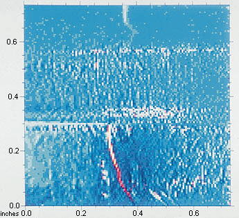 Thermographic Imaging